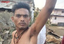 सावली : वाघाच्या हल्ल्यात युवक जखमी