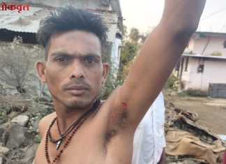 सावली : वाघाच्या हल्ल्यात युवक जखमी