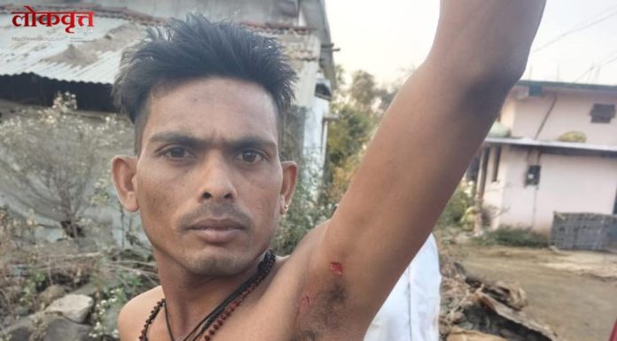 सावली : वाघाच्या हल्ल्यात युवक जखमी